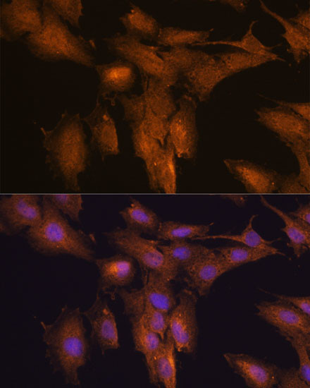 TSLP Antibody in Immunocytochemistry (ICC/IF)