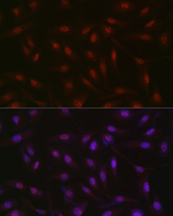 RBM14 Antibody in Immunocytochemistry (ICC/IF)