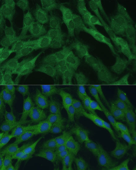 IDH1 Antibody in Immunocytochemistry (ICC/IF)