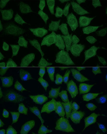 IDH1 Antibody in Immunocytochemistry (ICC/IF)