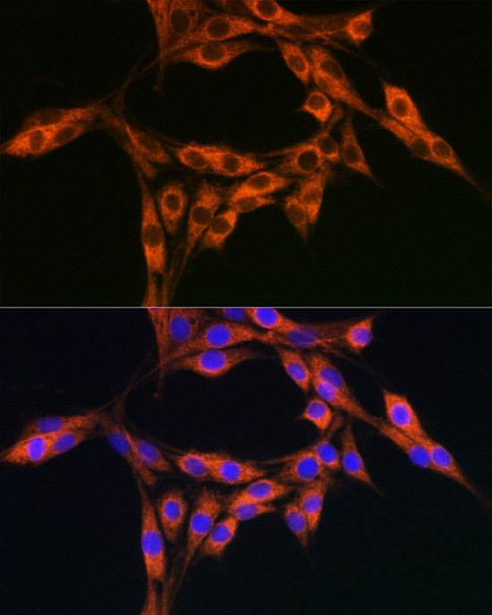 DBI Antibody in Immunocytochemistry (ICC/IF)