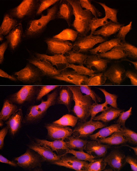 DBI Antibody in Immunocytochemistry (ICC/IF)