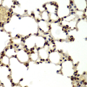 DDX5 Antibody in Immunohistochemistry (Paraffin) (IHC (P))