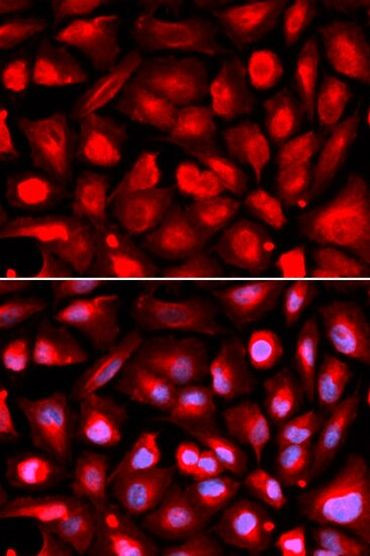 ETS1 Antibody in Immunocytochemistry (ICC/IF)