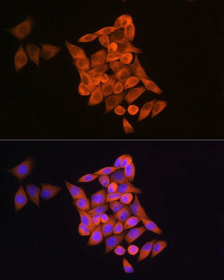 RRM1 Antibody in Immunocytochemistry (ICC/IF)