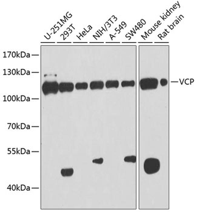 Vcp Polyclonal Antibody Pa5 89194