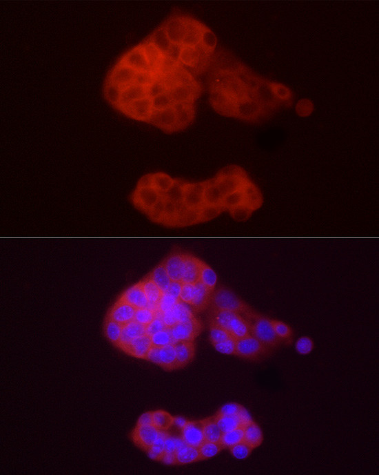 ADH5 Antibody in Immunocytochemistry (ICC/IF)