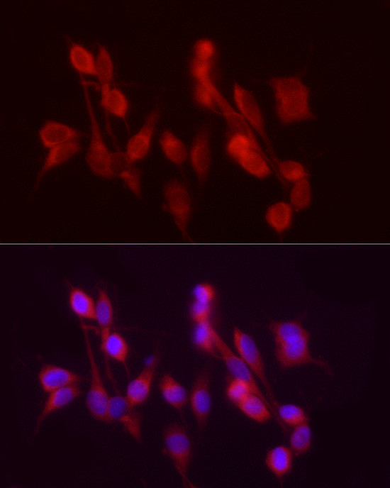 ADH5 Antibody in Immunocytochemistry (ICC/IF)