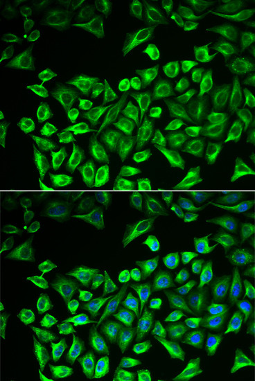 HAS3 Antibody in Immunocytochemistry (ICC/IF)