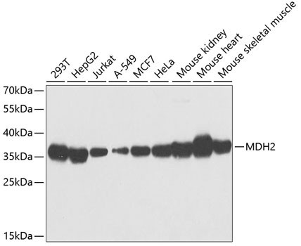 MDH2 Antibody in Western Blot (WB)