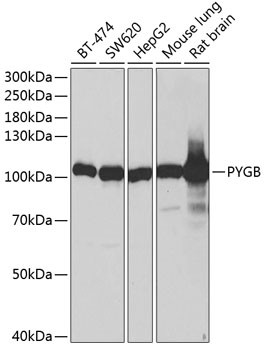 GPBB Antibody in Western Blot (WB)