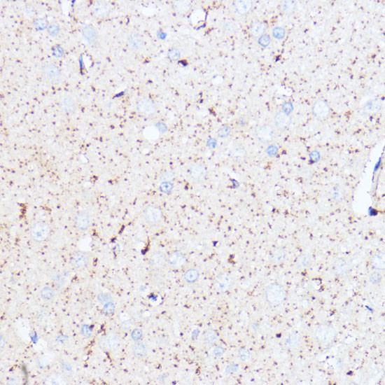 MAOA Antibody in Immunohistochemistry (Paraffin) (IHC (P))