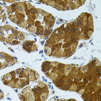 CETP Antibody in Immunohistochemistry (Paraffin) (IHC (P))