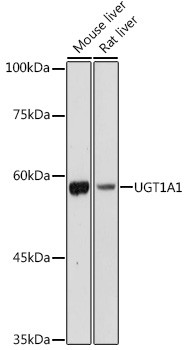 UGT1A1 Antibody in Western Blot (WB)