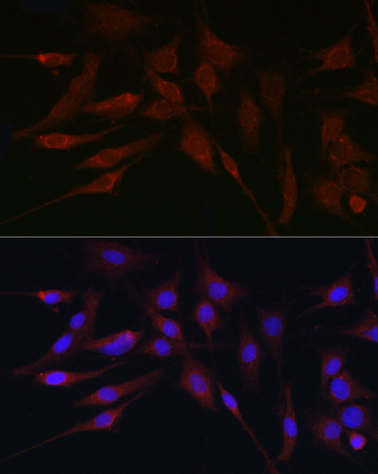 APOBEC3G Antibody in Immunocytochemistry (ICC/IF)