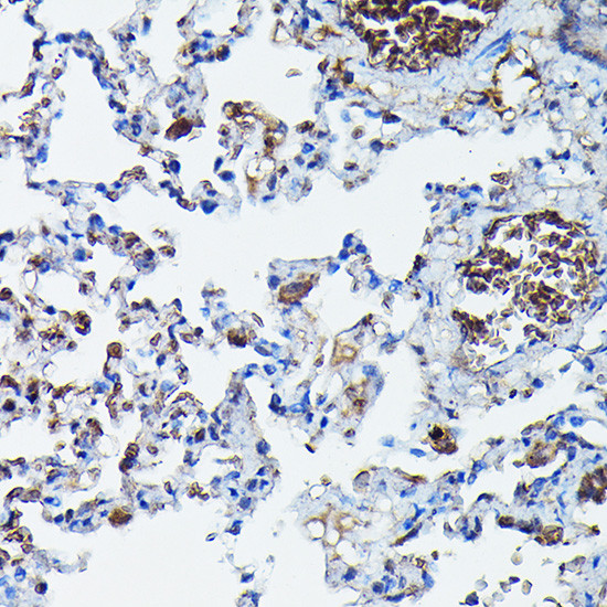 APOBEC3G Antibody in Immunohistochemistry (Paraffin) (IHC (P))