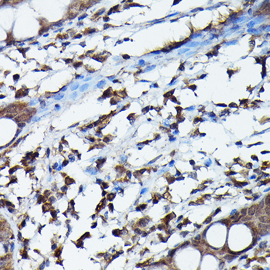 APOBEC3G Antibody in Immunohistochemistry (Paraffin) (IHC (P))