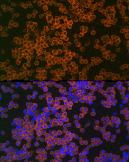 CD38 Antibody in Immunocytochemistry (ICC/IF)