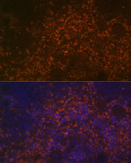 CD38 Antibody in Immunohistochemistry (Paraffin) (IHC (P))