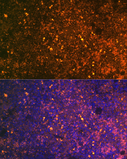 CD38 Antibody in Immunohistochemistry (Paraffin) (IHC (P))