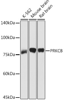 PKC beta Antibody in Western Blot (WB)