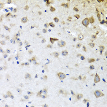 CPA6 Antibody in Immunohistochemistry (Paraffin) (IHC (P))