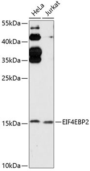 4E-BP2 Antibody in Western Blot (WB)