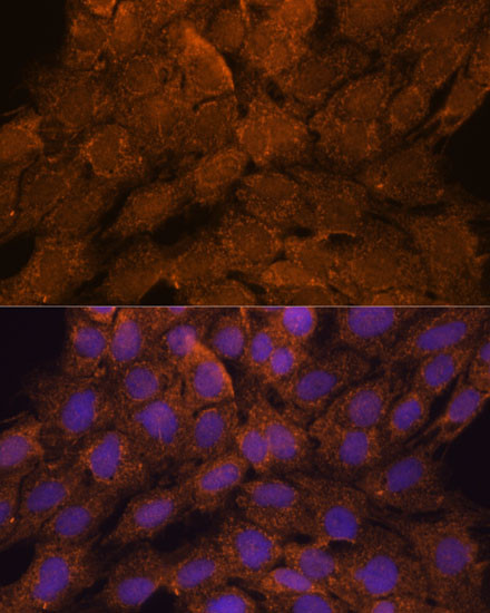 TNFAIP8L2 Antibody in Immunocytochemistry (ICC/IF)