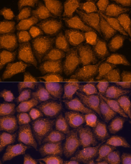 TNFAIP8L2 Antibody in Immunocytochemistry (ICC/IF)