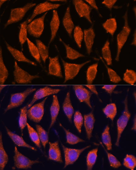 TNFAIP8L2 Antibody in Immunocytochemistry (ICC/IF)