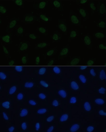 HSF1 Antibody in Immunocytochemistry (ICC/IF)