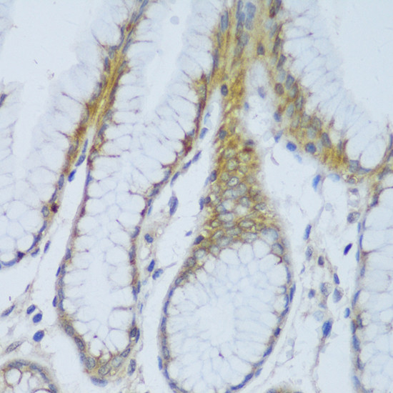 EFCAB4B Antibody in Immunohistochemistry (Paraffin) (IHC (P))