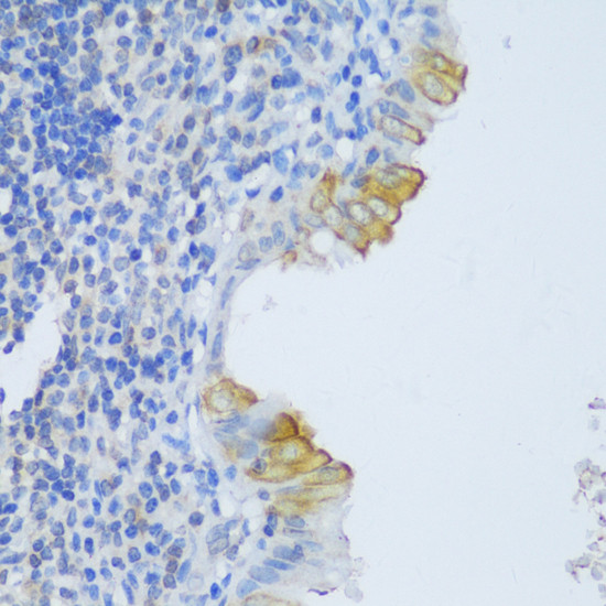 EFCAB4B Antibody in Immunohistochemistry (Paraffin) (IHC (P))