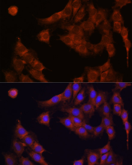 GANAB Antibody in Immunocytochemistry (ICC/IF)