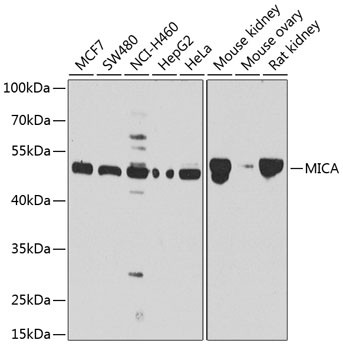 MICA Antibody in Western Blot (WB)