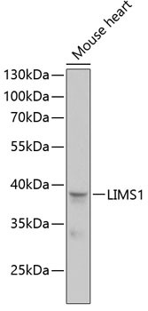 LIMS1 Antibody in Western Blot (WB)