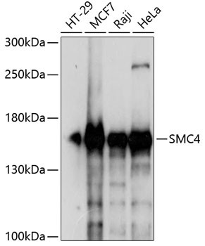 SMC4 Antibody in Western Blot (WB)
