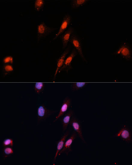 SMAD5 Antibody in Immunocytochemistry (ICC/IF)