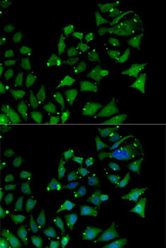 AIPL1 Antibody in Immunocytochemistry (ICC/IF)