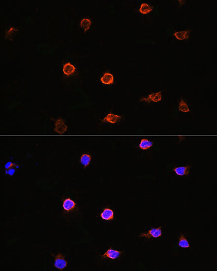 AIPL1 Antibody in Immunocytochemistry (ICC/IF)