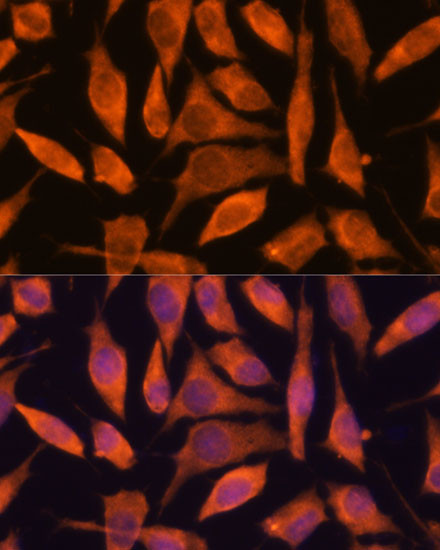 SCRN3 Antibody in Immunocytochemistry (ICC/IF)