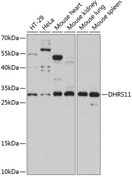 DHRS11 Antibody in Western Blot (WB)
