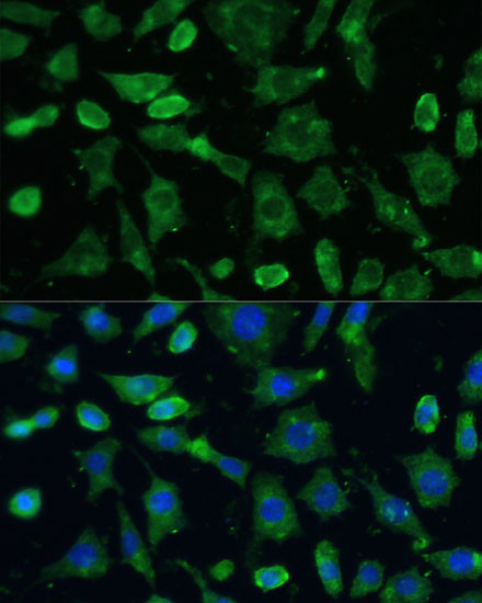 SPARC Antibody in Immunocytochemistry (ICC/IF)