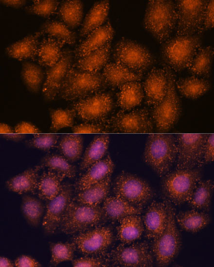 SMYD3 Antibody in Immunocytochemistry (ICC/IF)