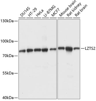 LZTS2 Antibody in Western Blot (WB)