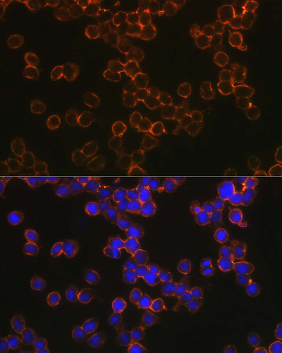 DC-SIGN Antibody in Immunocytochemistry (ICC/IF)