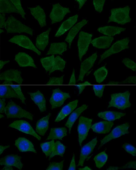 COX15 Antibody in Immunocytochemistry (ICC/IF)