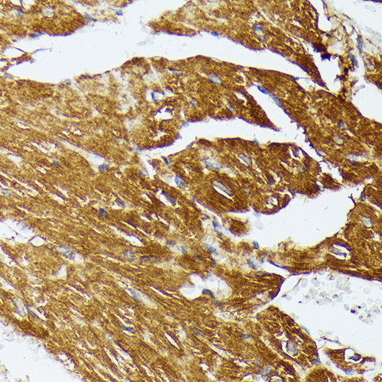 COX15 Antibody in Immunohistochemistry (Paraffin) (IHC (P))