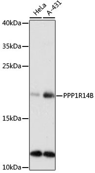 PP14B Antibody in Western Blot (WB)