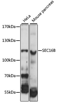 LZTR2 Antibody in Western Blot (WB)